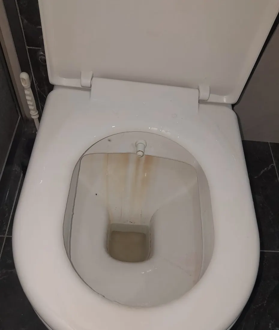 Temizlik öncesi kireç ve pas lekeli klozet